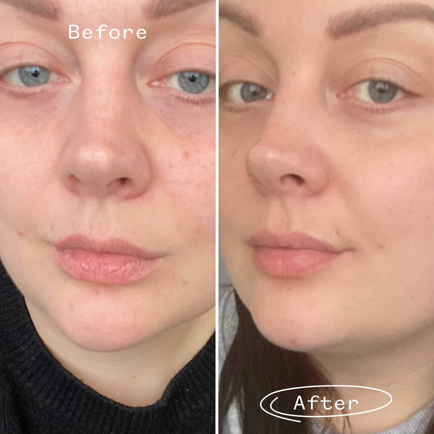 Pai Skincare