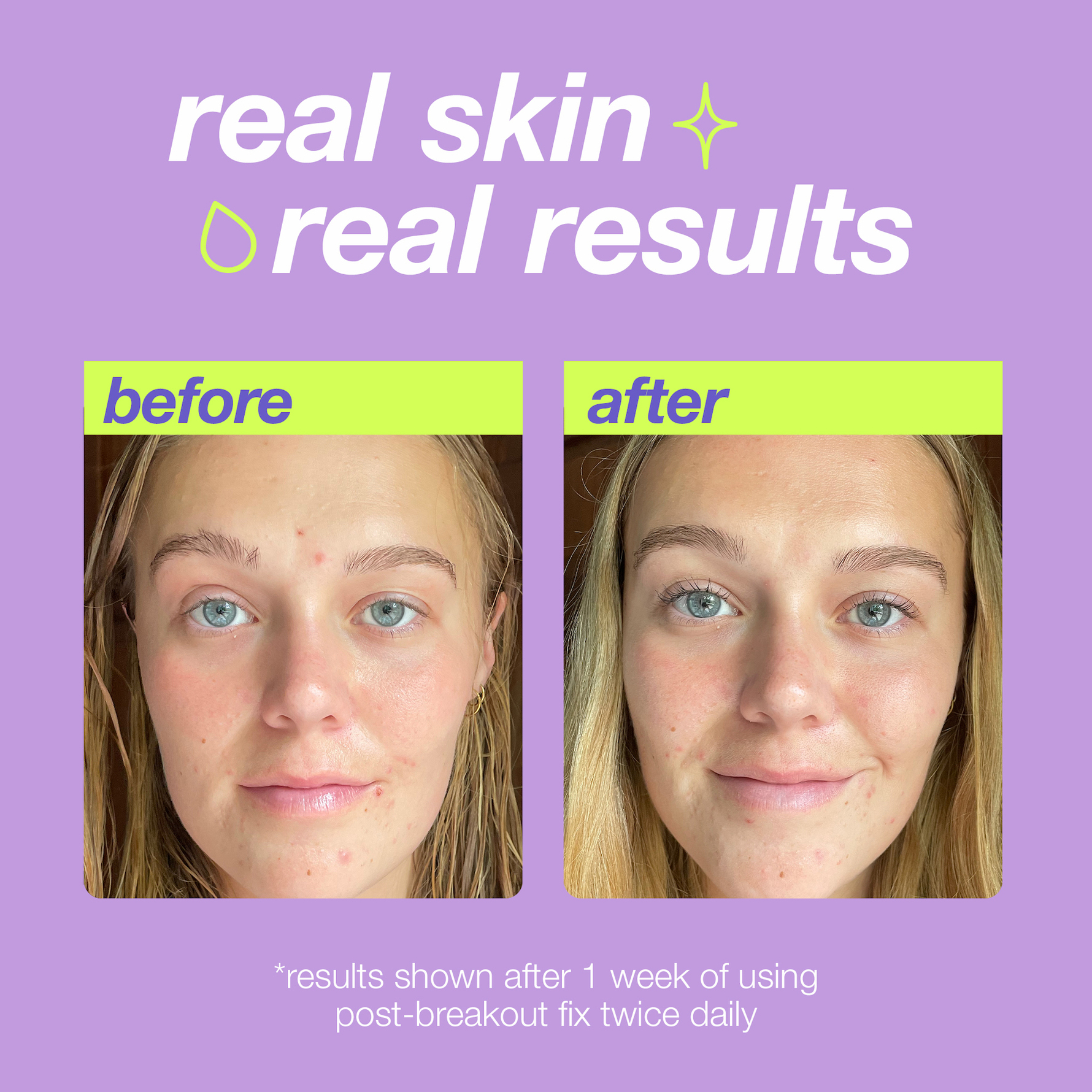 Clear Start (by Dermalogica)