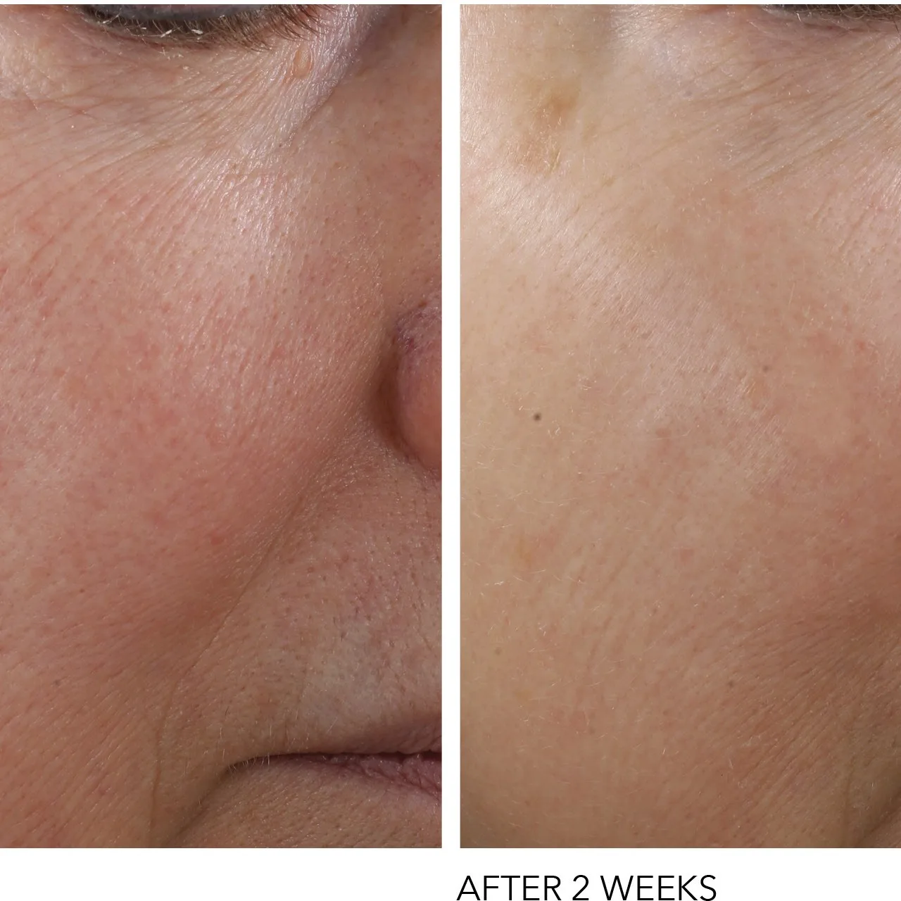 Dr Dennis Gross Advanced Retinol + Ferulic Texture Renewal Serum