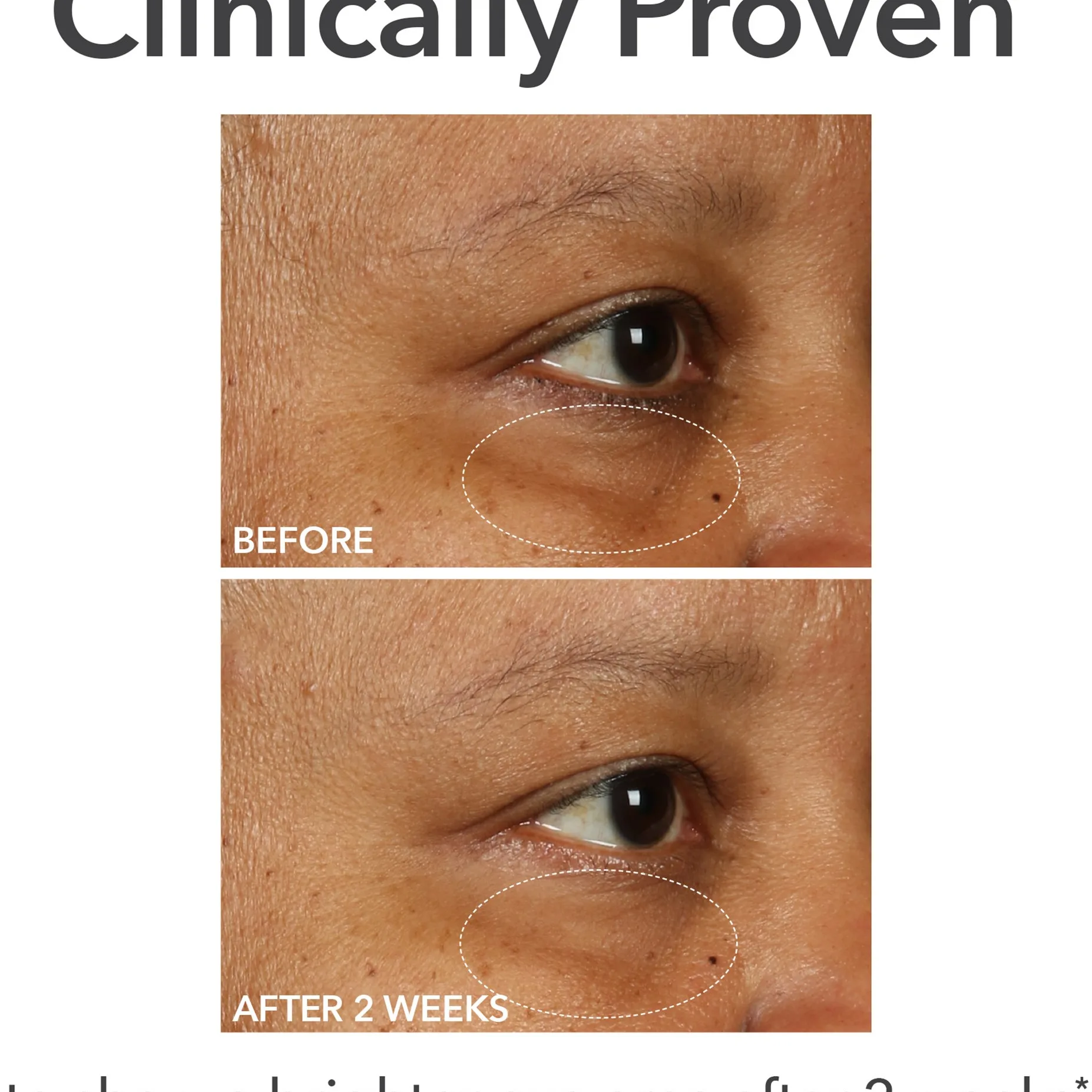 Dr Dennis Gross DermInfusions™ Fill & Repair Eye Cream (15 g)