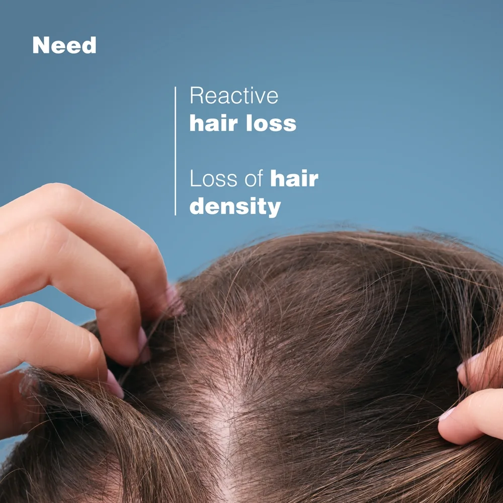Ducray Anaphase Anti-Hair Loss & Growth Shampoo Schampo Mot håravfall 400 ml