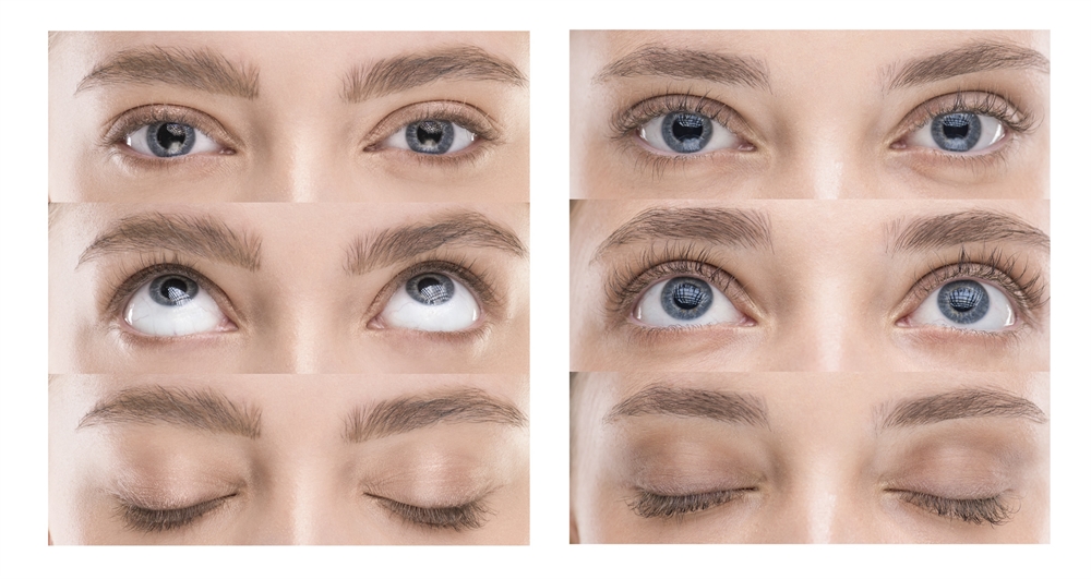 FacEvolution